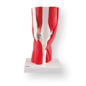 Knee joint, in 12 pieces - Anatomy and pathology - My Podology