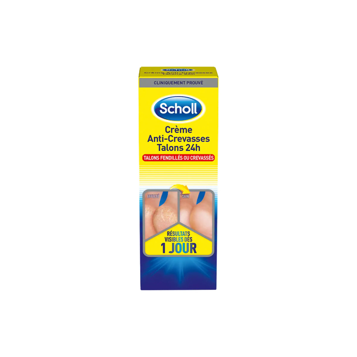 Anti-Cracks Cream K+ Urea 25% - 2 capacities - Scholl Scholl 