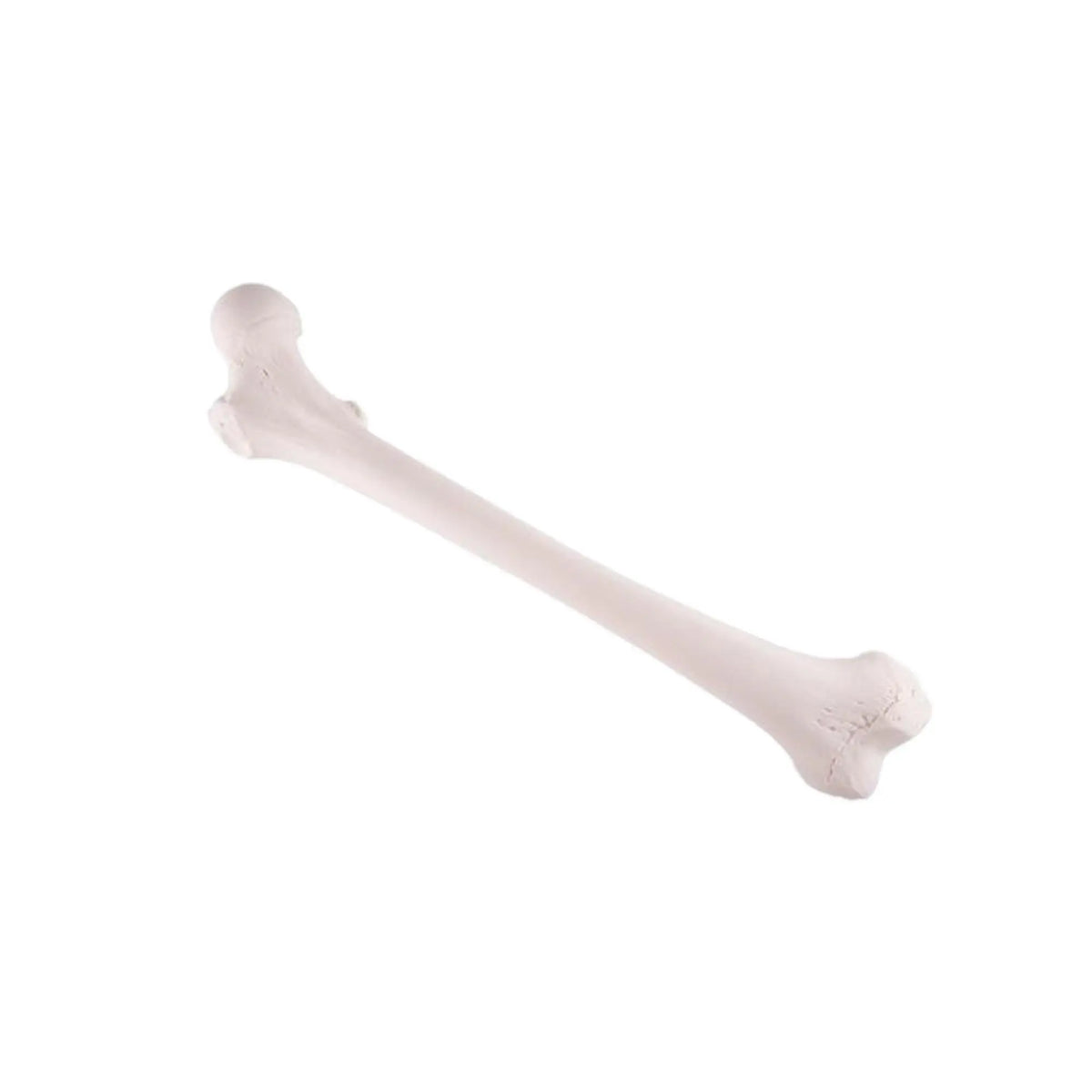 Femur - Anatomy and pathology - My Podiatry