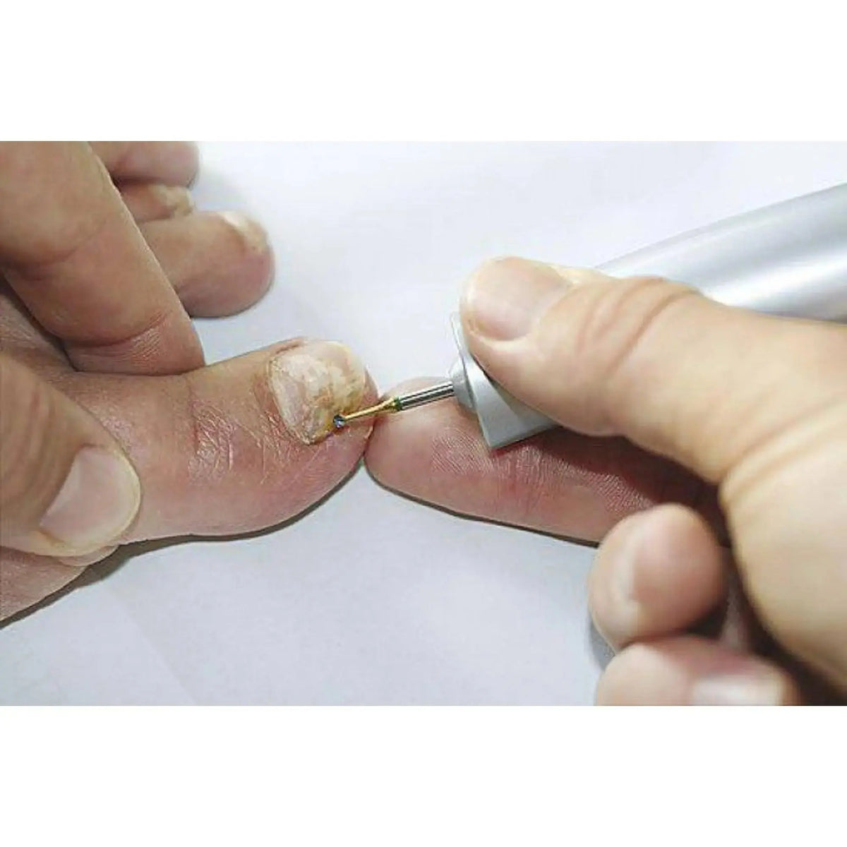 Fresa de carburo de tungsteno 1SXM - Enucleación de callos - 2,1 mm - My Podologie