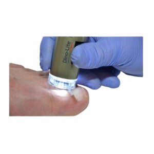 Medical Microscope - 1.3 MP Podoscope - Dino-Lite Dino-Lite 