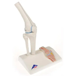 Mini knee joint with cross section, on base - Anatomy and pathology - My Podiatry