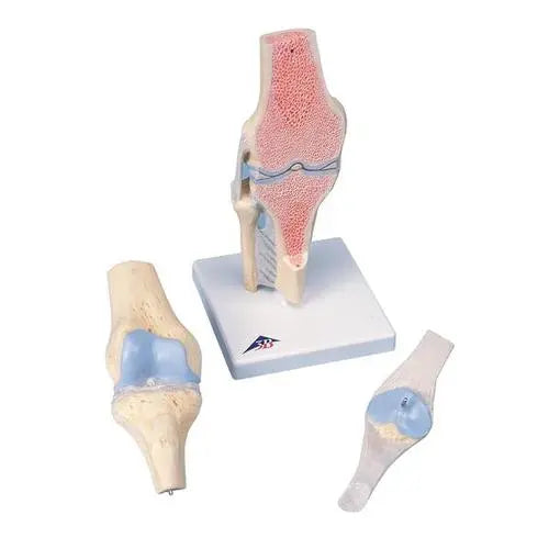 Cutting model of the knee joint, in 3 parts - Anatomy and pathology - My Podiatry