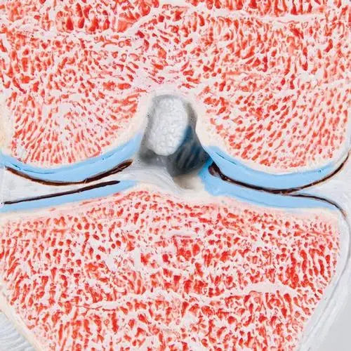 Cutting model of the knee joint, in 3 parts - Anatomy and pathology - My Podiatry