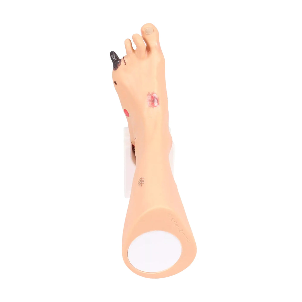Foot model with wounds - Anatomy and pathology My Podiatry 