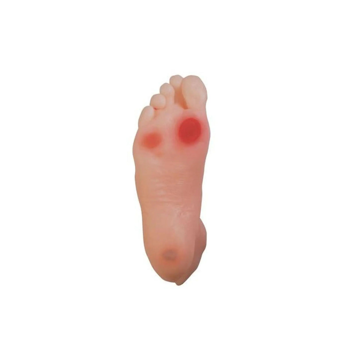 Diabetic foot model - Anatomy and pathology - My Podiatry
