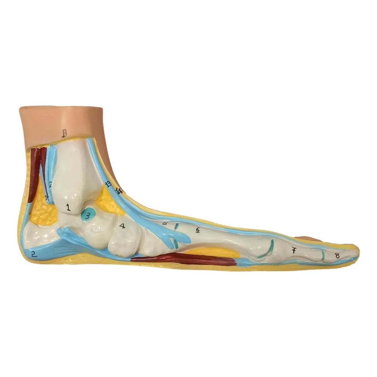 Flat foot model - Herbitas - My Podiatry