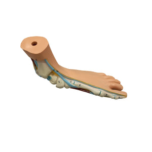 Flat foot model - Herbitas - My Podiatry