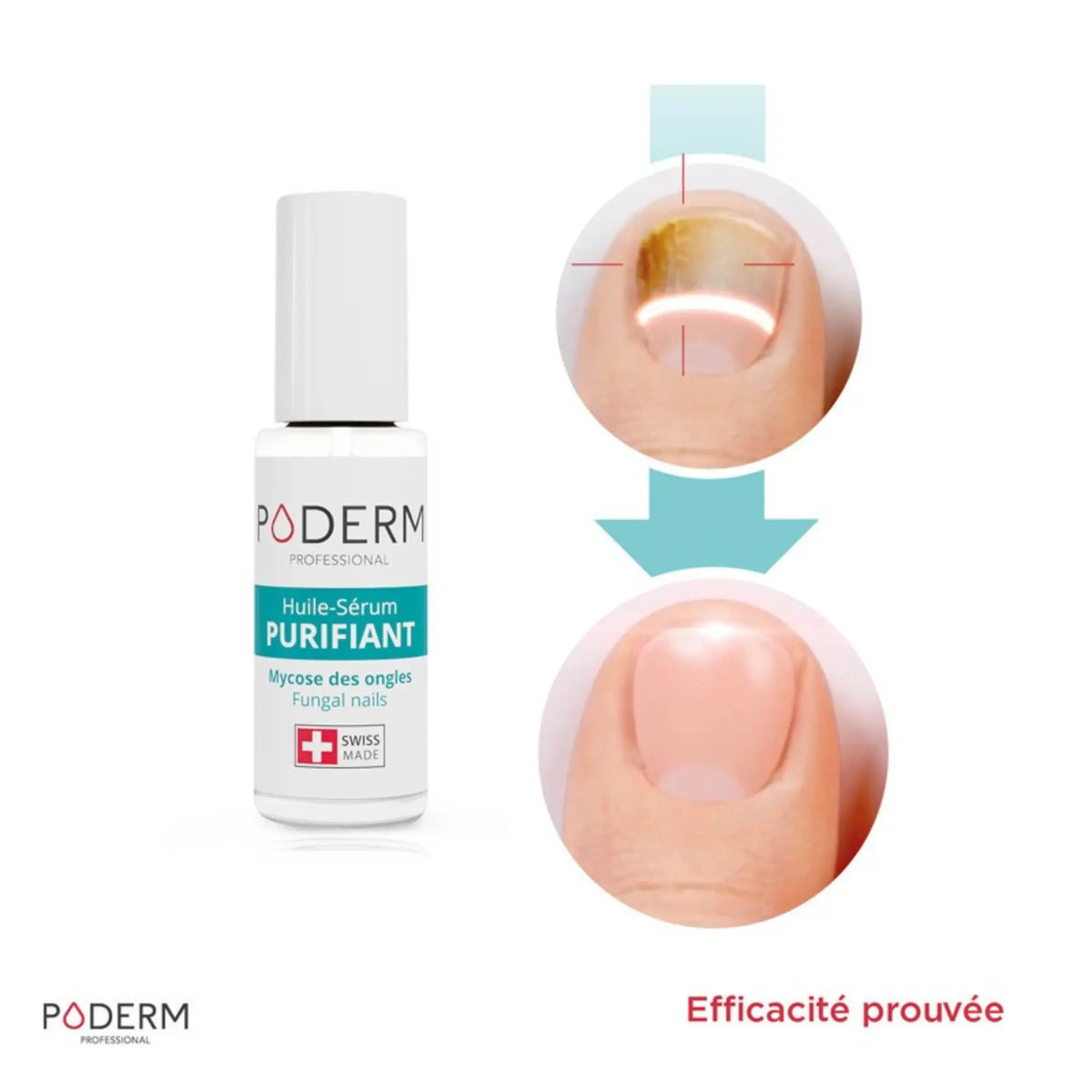 Purifying Serum Treatment Pack (8 ml) + Booster (6 ml) - Poderm Professional 