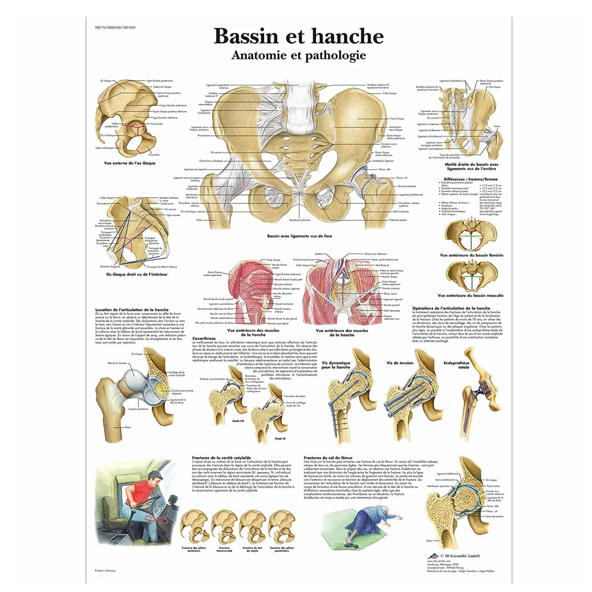 Anatomical board - Pelvis and hip - Anatomy and pathology - 3B Scientific - My Podiatry