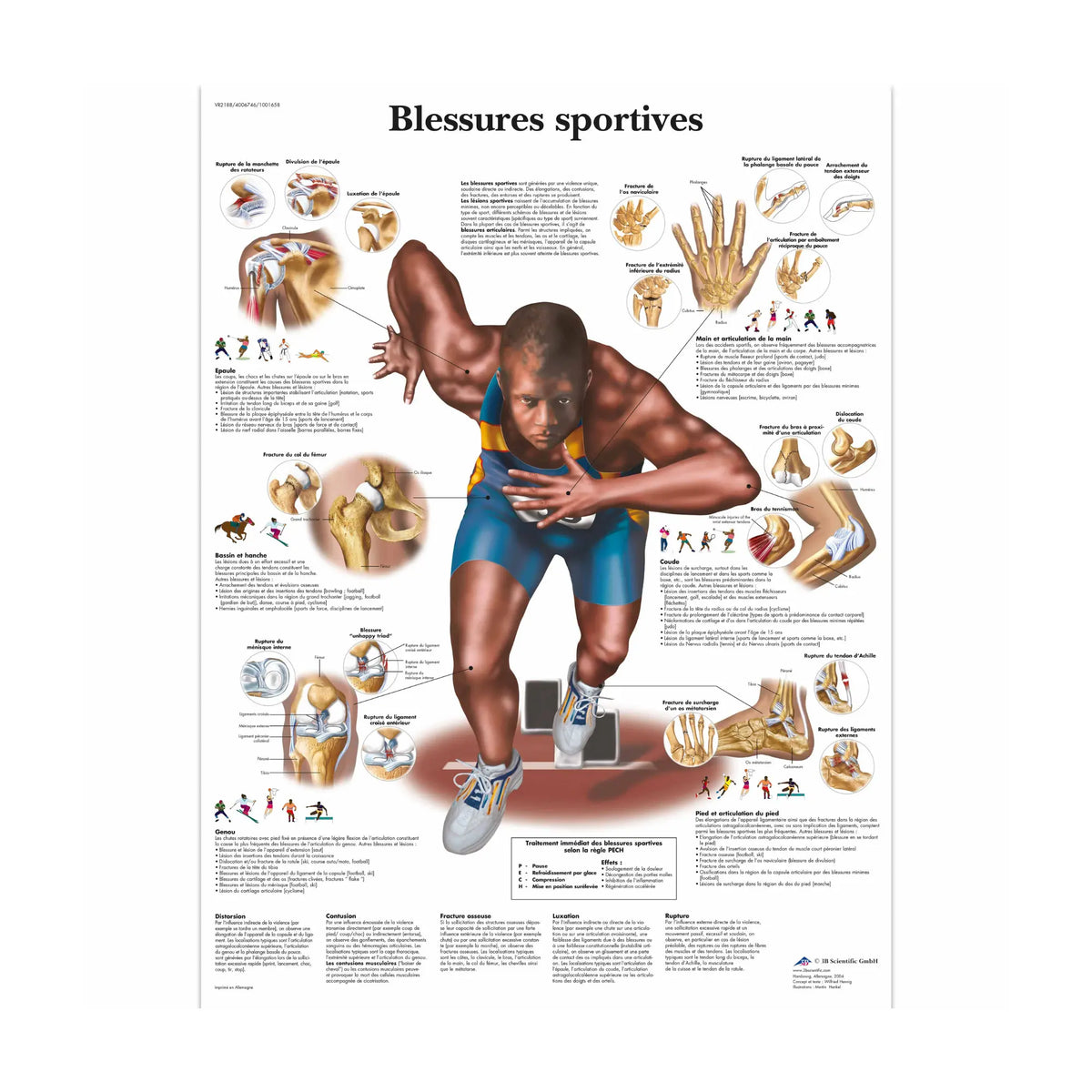 Anatomical board - Sports injuries - My Podiatry