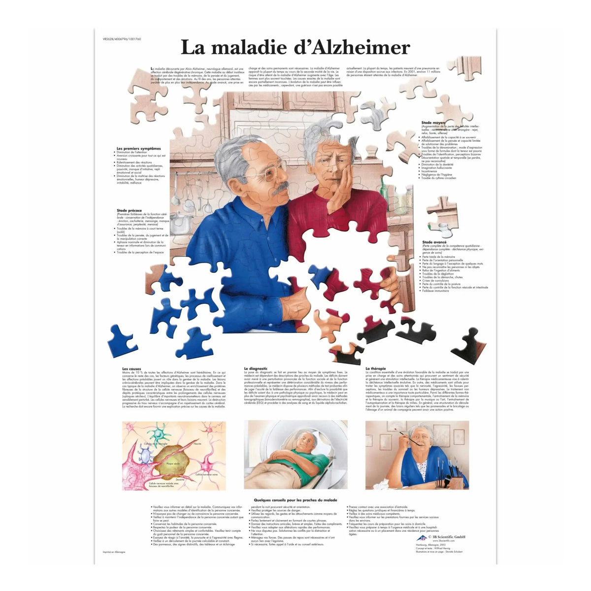Anatomical board - Alzheimer's disease - Anatomy and pathology - My Podiatry
