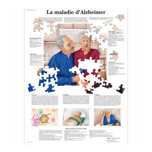 Anatomical board - Alzheimer's disease - Anatomy and pathology - My Podiatry