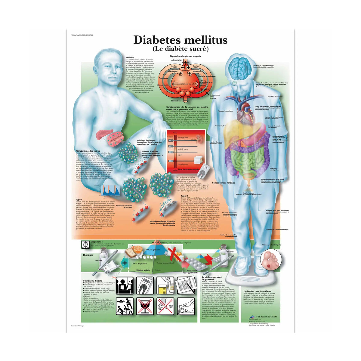 Anatomical board - Diabetes - Anatomy and pathology - My Podiatry
