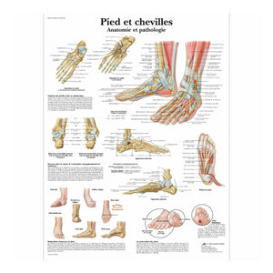 Anatomical board - Foot and ankles - Anatomy and pathology 3B Scientific 