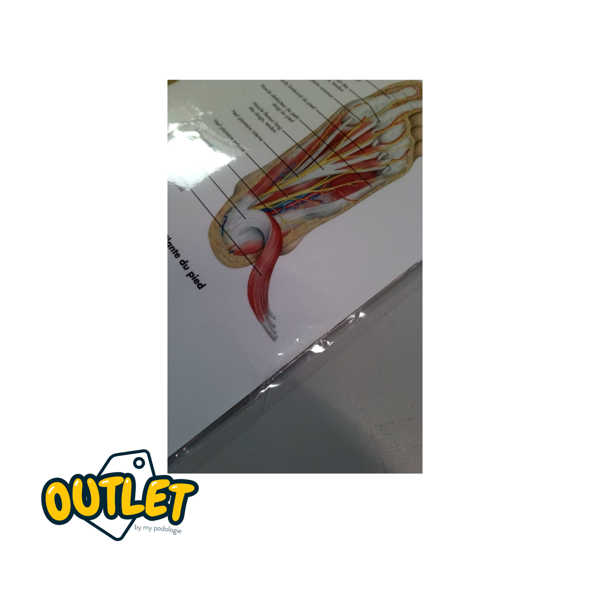 Planche anatomique - Pied et chevilles - Anatomie et pathologie // Défaut