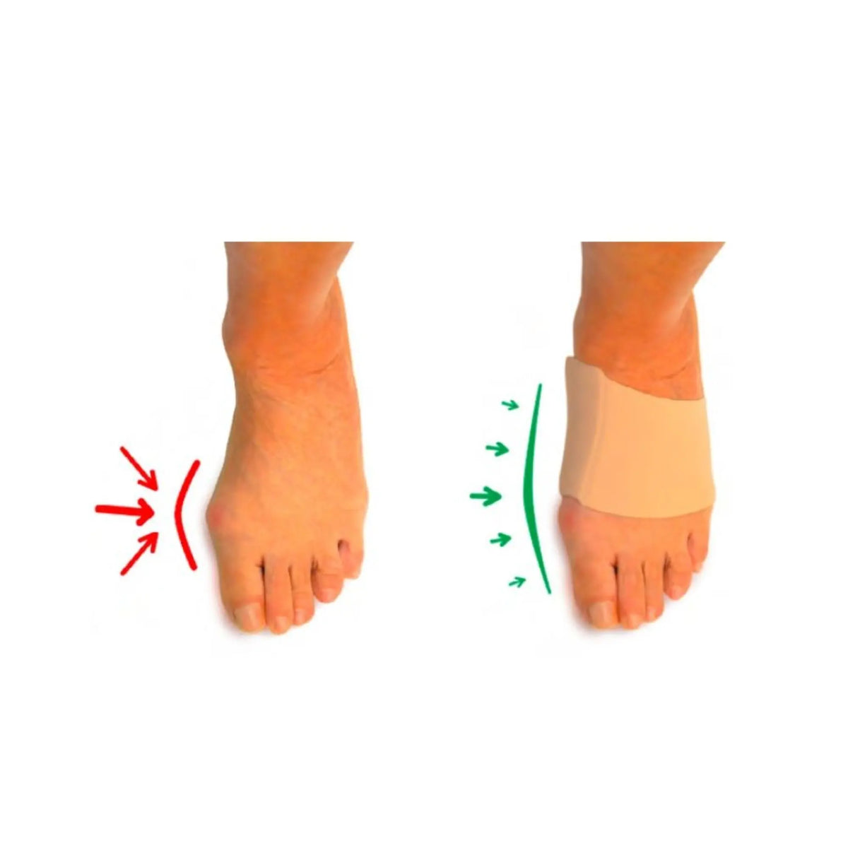 Hallux Valgus Protection - Size S - Herbitas Fresco Podologia 
