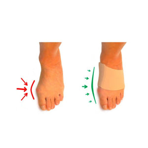 Hallux Valgus Protection - Size S - Herbitas Fresco Podologia 