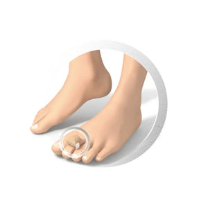 Foam rubber toe protection - 3 sizes available - Ruck Ruck 