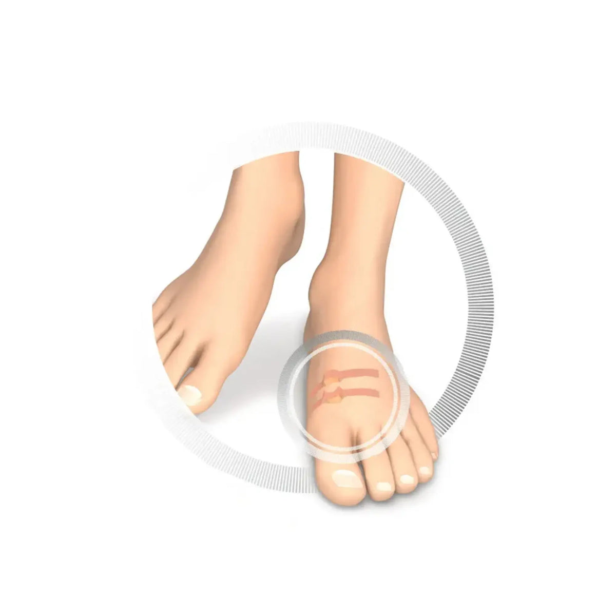Toe Protector - Soft Latex Hollow Pad - Protects Against Friction - 9 Pieces - Ruck Ruck 
