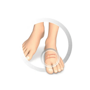 Toe Protector - Soft Latex Hollow Pad - Protects Against Friction - 9 Pieces - Ruck Ruck 