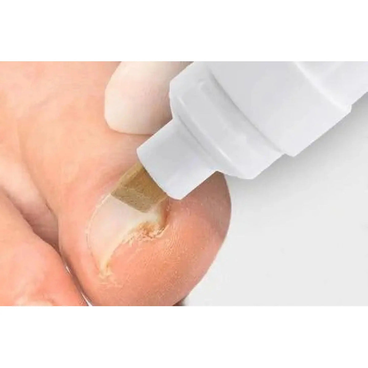 Pluma Aktivator B/S - Preparación de uñas - 8 ml - My Podologie