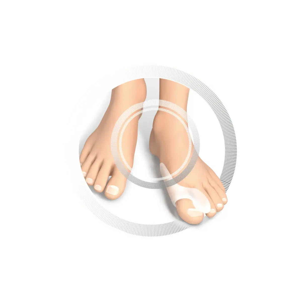 Gel big toe separator and hallux valgus protection - Pack of 2 pieces - Ruck Ruck 