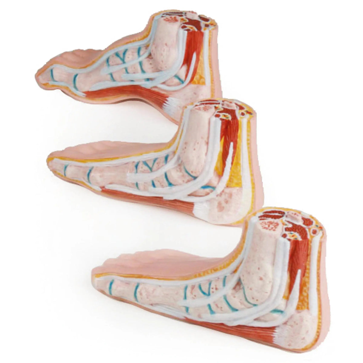 Series of 3 mini feet (physiological, flat and hollow) - My Podiatry