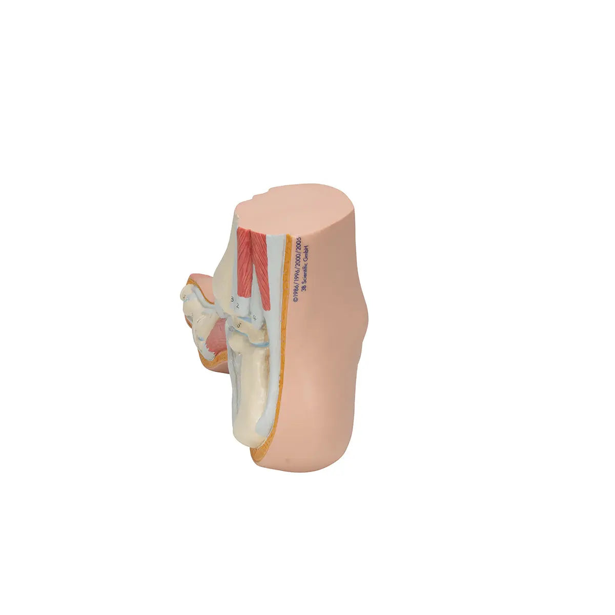 Skeleton of a hollow foot (Pes Cavus) - My Podiatry