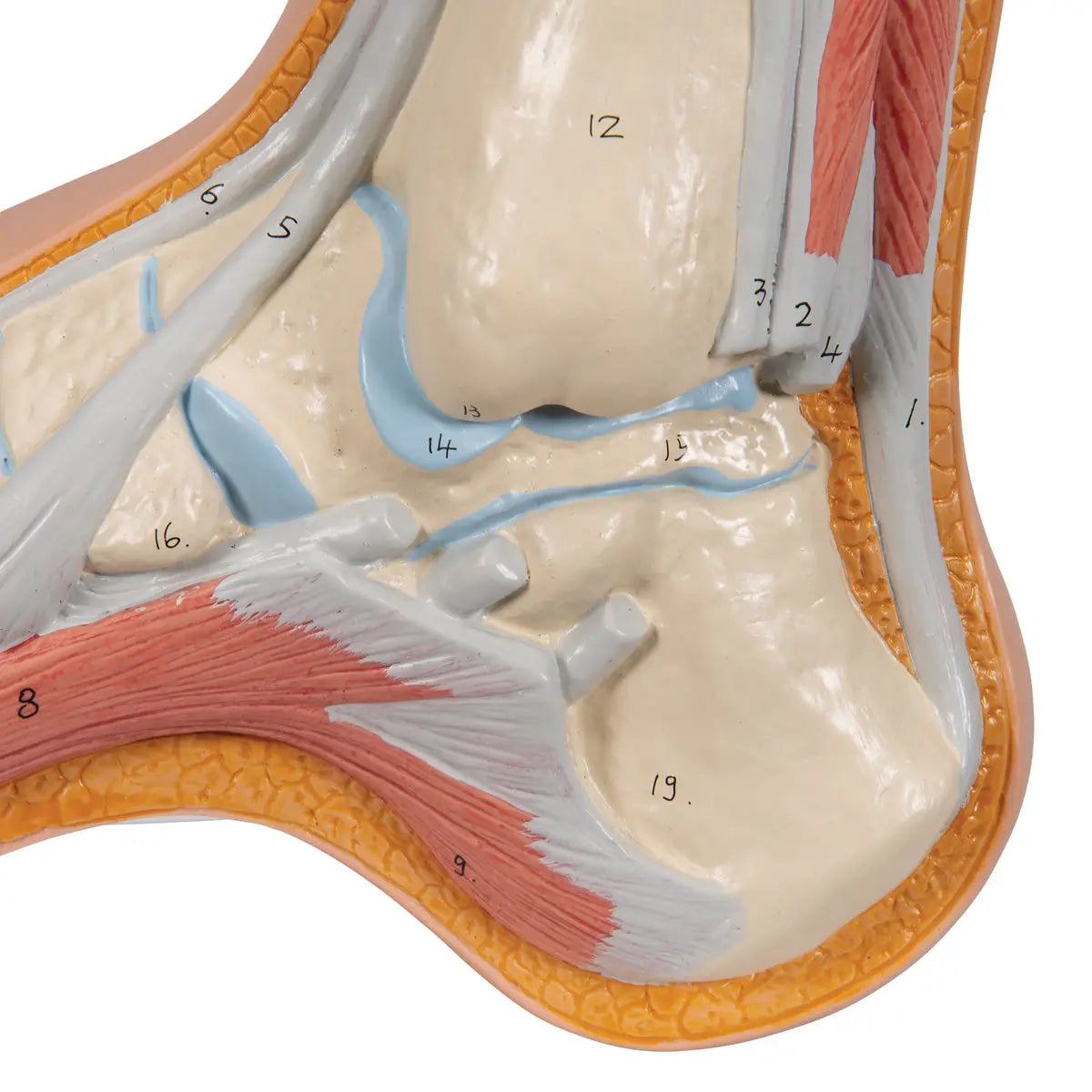 Skeleton of a hollow foot (Pes Cavus) - My Podiatry