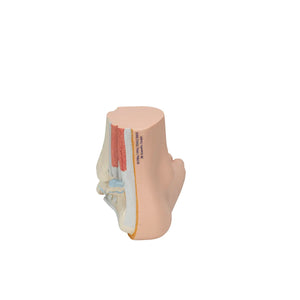 Skeleton of a flat foot (Pes Planus) - My Podiatry