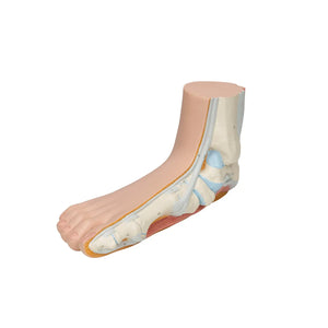 Skeleton of a flat foot (Pes Planus) - My Podiatry