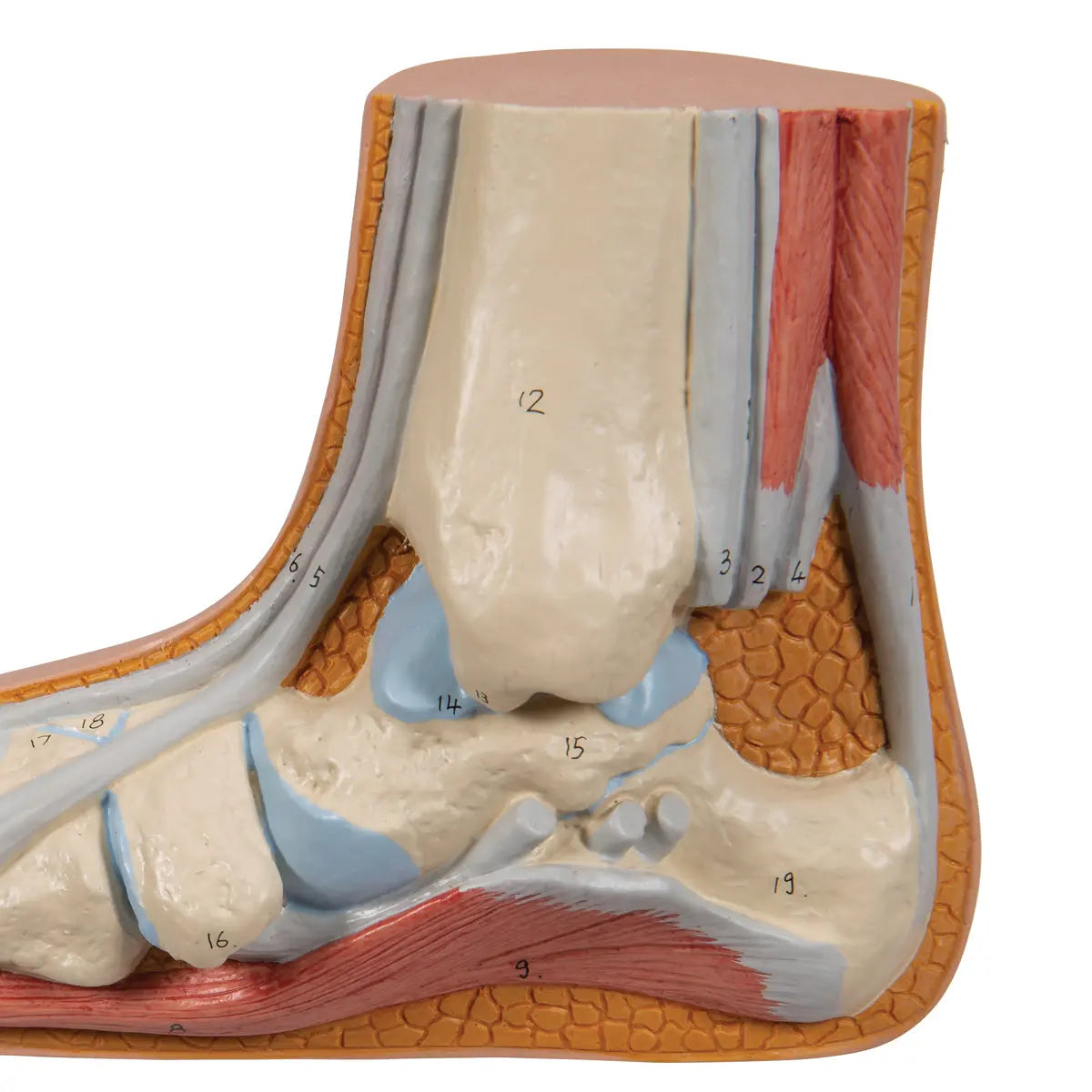 Skeleton of a flat foot (Pes Planus) - My Podiatry