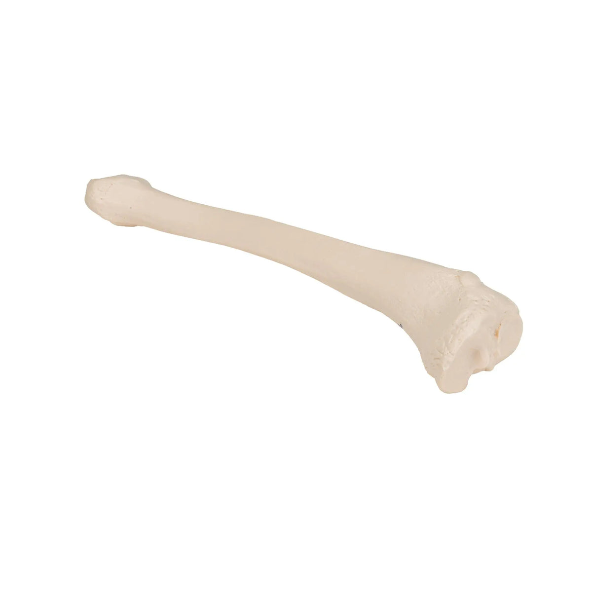 Tibia - Anatomy and pathology - My Podiatry