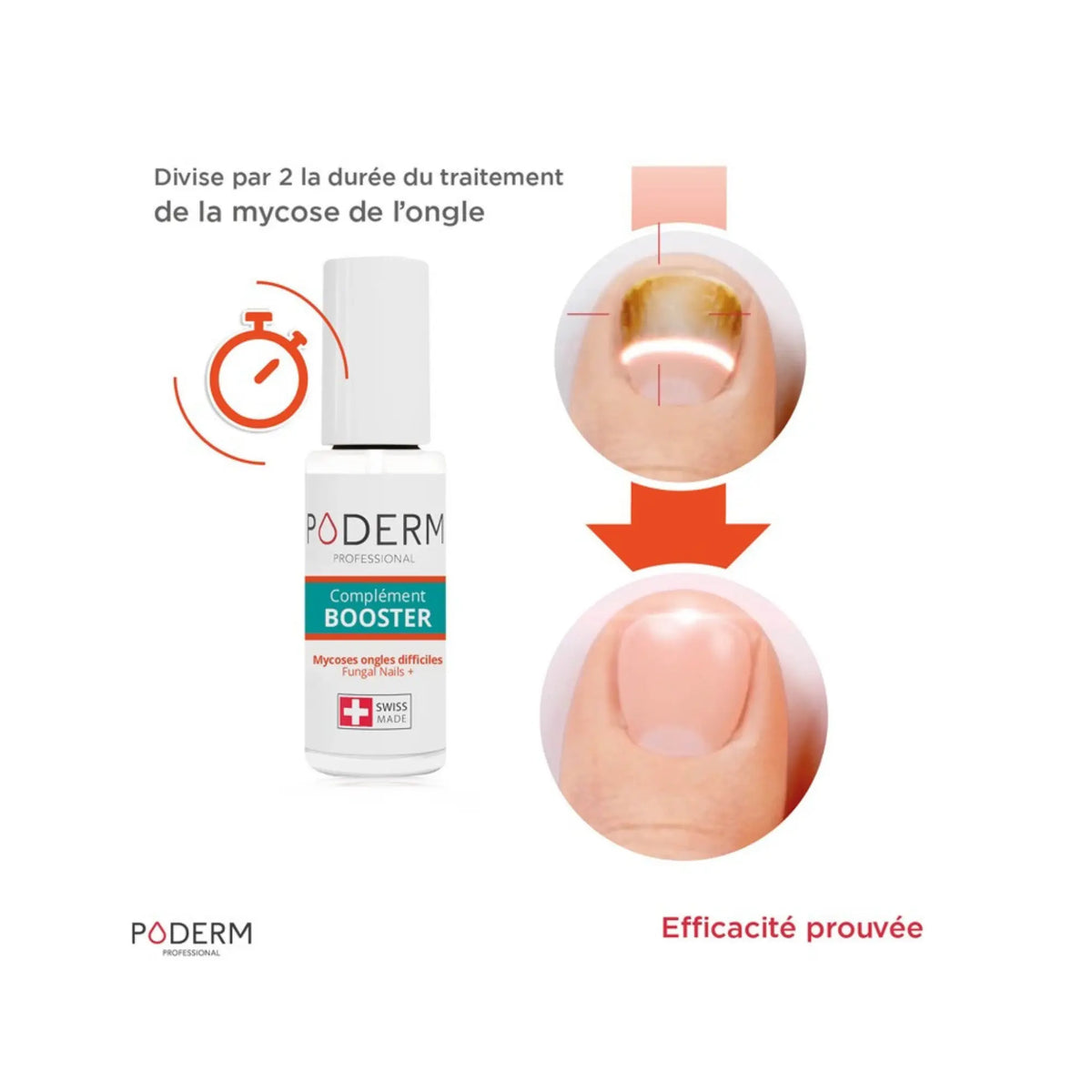Difficult mycoses treatment - 6ml - Booster - Poderm Professional