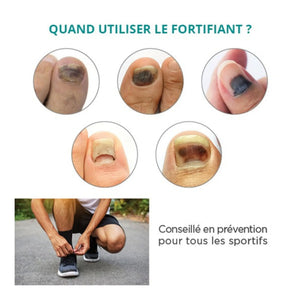 Treatment Black, traumatized nails - 30ml - Strengthening - Application with pipette - Poderm Professional - My Podologie