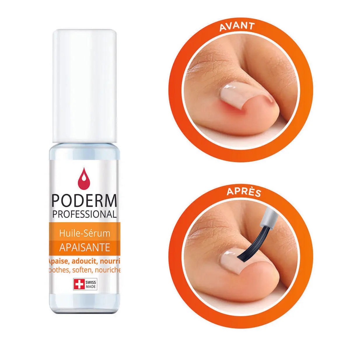 Tratamiento sérum para uñas encarnadas e incrustadas - 8 ml - Calmante - Poderm Professional - My Podologie