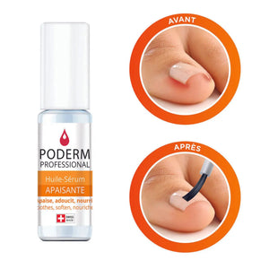 Tratamiento sérum para uñas encarnadas e incrustadas - 8 ml - Calmante - Poderm Professional - My Podologie