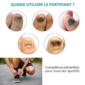 Serum Treatment Black, traumatized nails - 8ml - Fortifying - Poderm Professional - My Podologie