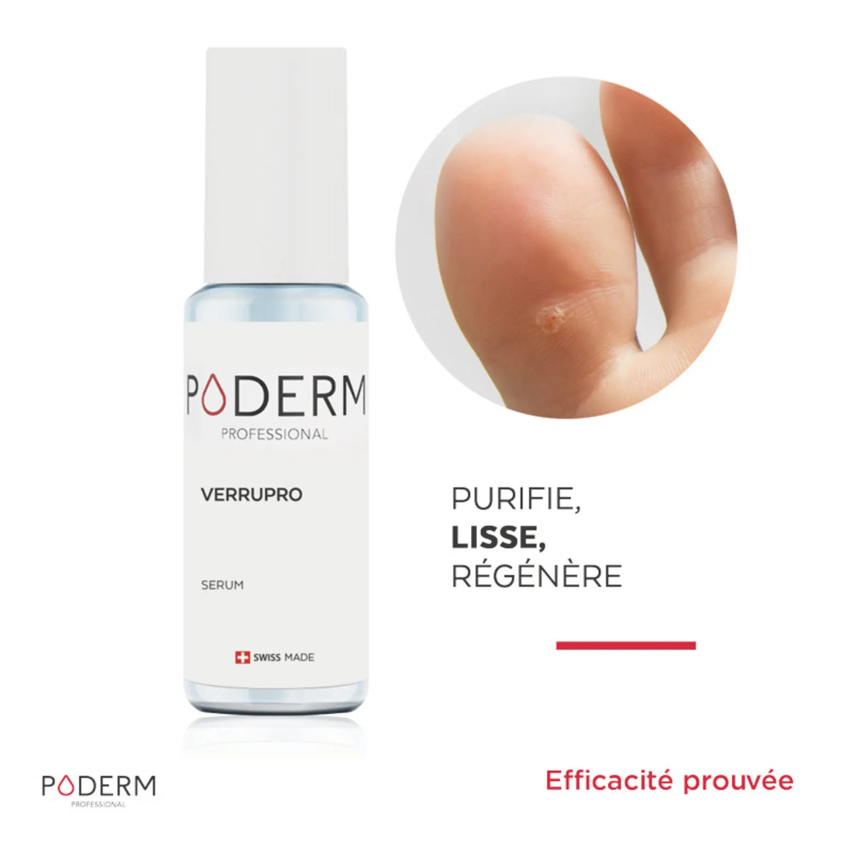 Verrupro Treatment - 6ml - Against warts - Poderm Professional