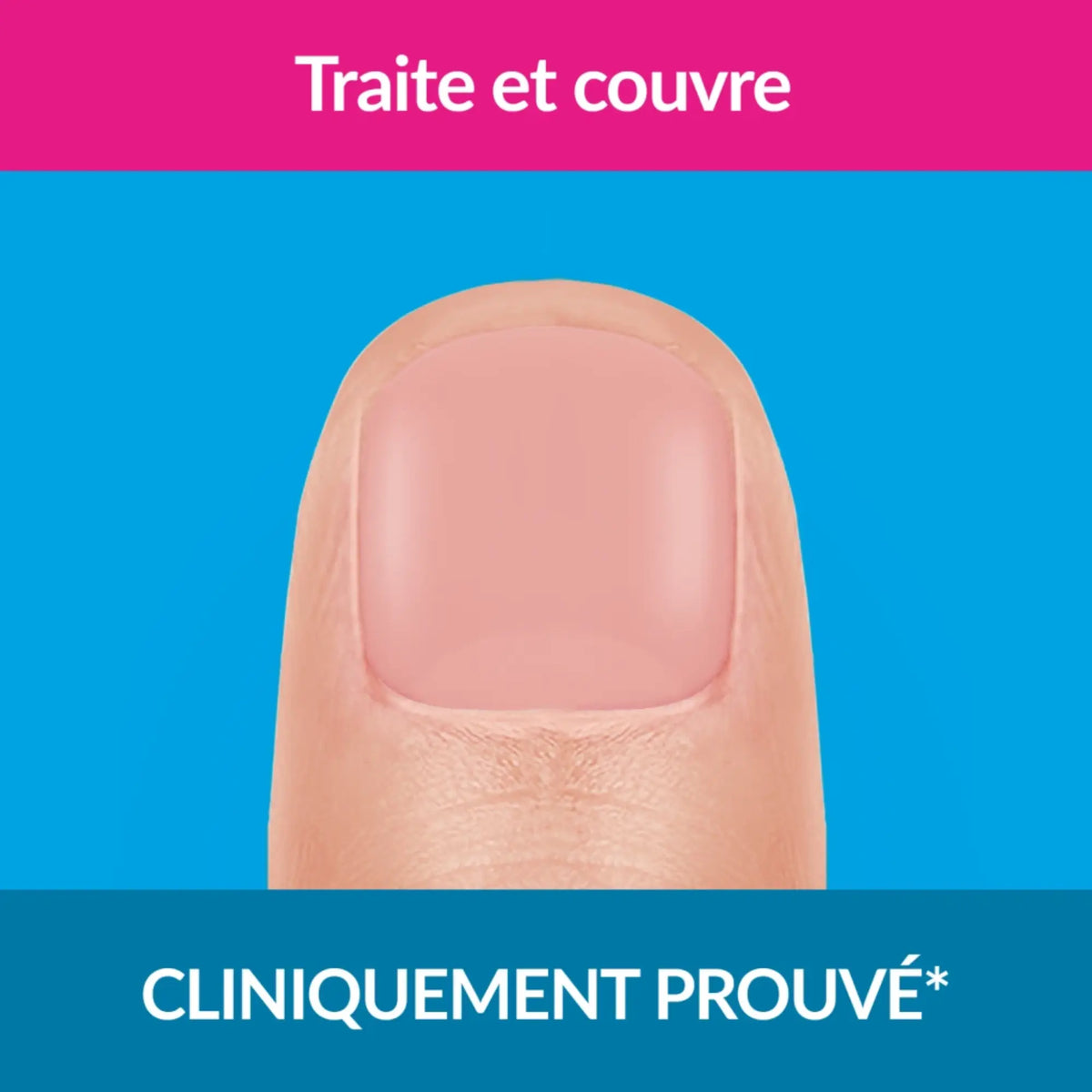 Strong nail fungus treatment in nude color 30ml - Excilor Excilor 