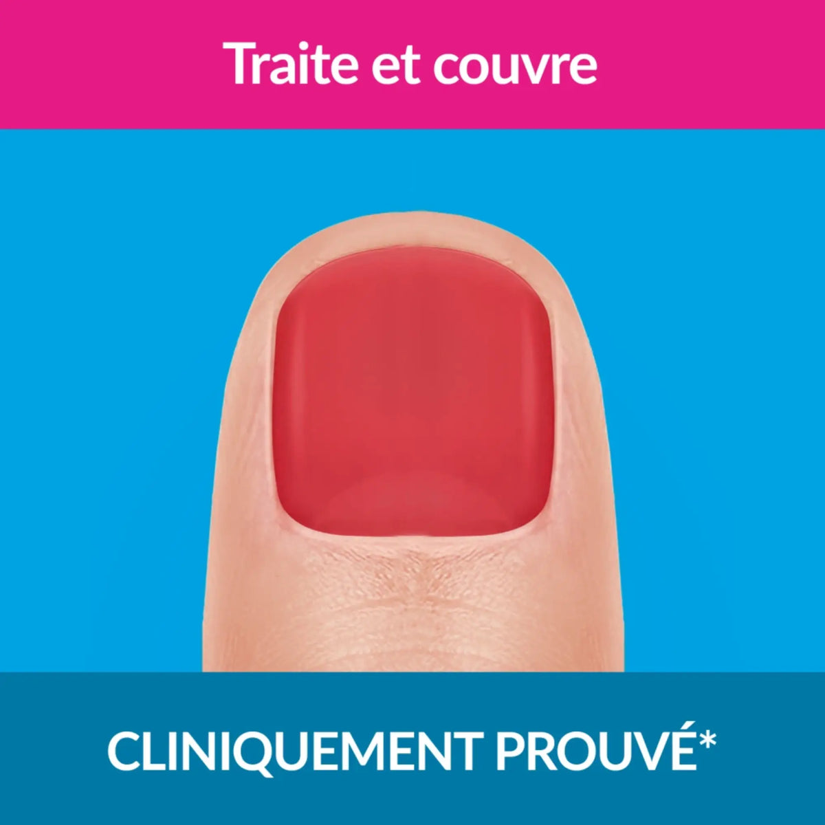 Strong nail fungus treatment red color 30ml - Excilor Excilor 